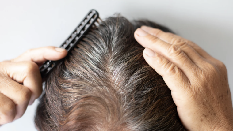Hair Restoration Solutions in Rockville, Maryland with Medical Experts